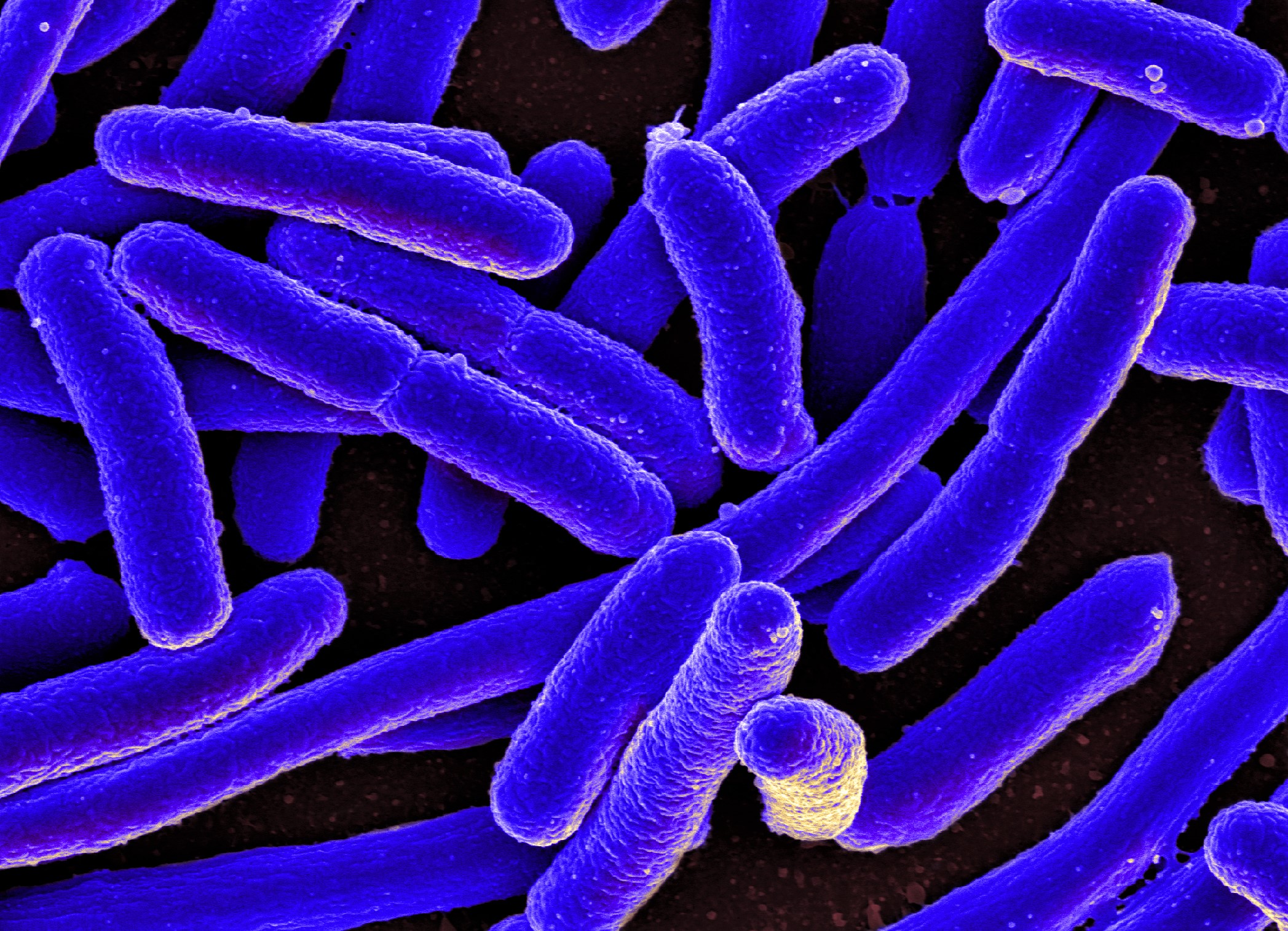 E. coli ​Contamination ​in Jar Water ​Omnipresent